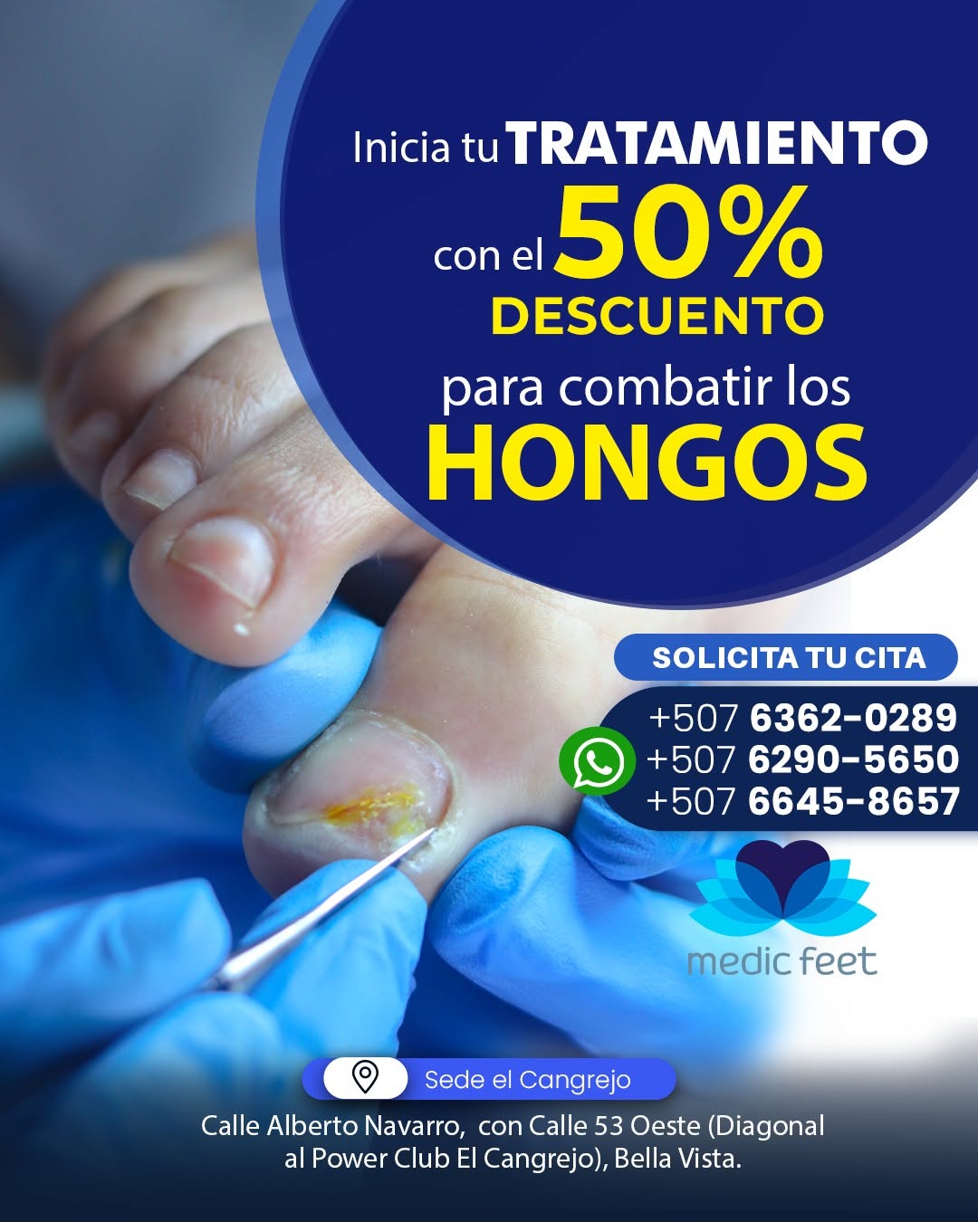Hongos en las uñas